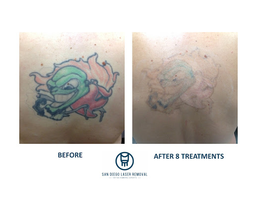 Explore tattoo ideas dad passed away, creative tattoo ideas in San Diego, available at Removery Tattoo Removal & Fading