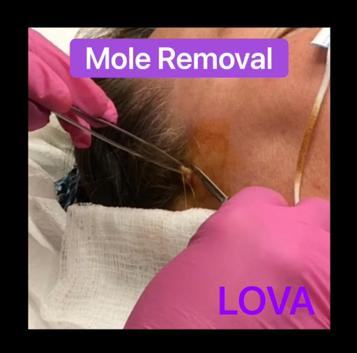 Explore japanese tattoo ideas forearm, creative tattoo ideas in Lake Oswego, available at Lake Oswego Vein and Aesthetic LOVA