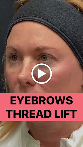 Explore small sailor moon tattoo ideas, creative tattoo ideas in Lake Oswego, available at Lake Oswego Vein and Aesthetic LOVA