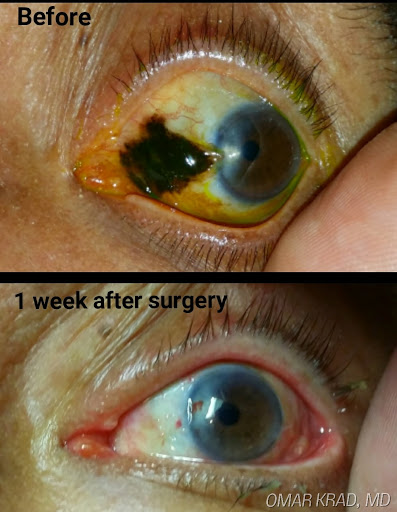 Omar Krad, MD image