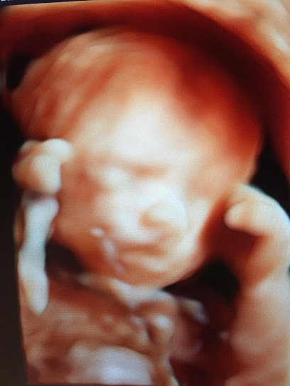 Meet the BABY Ultrasound