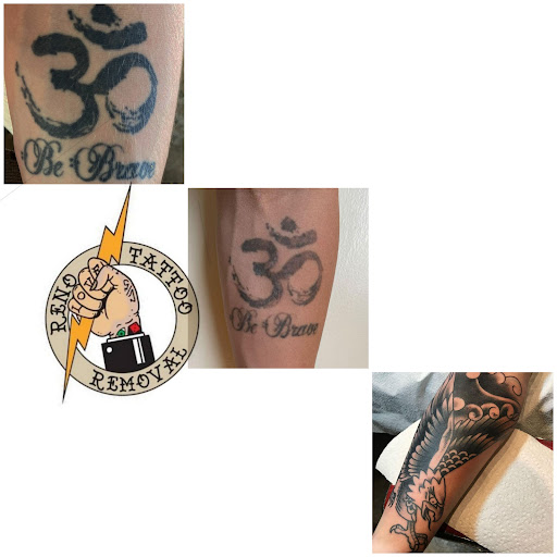 Explore tattoo ideas ocean, creative tattoo ideas in Reno, available at Reno Tattoo Removal