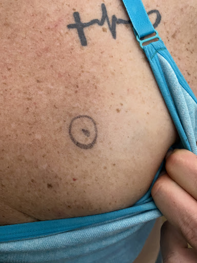 Explore love symbol tattoo ideas, creative tattoo ideas in Lake Jackson, available at Second Chance Laser Tattoo Removal