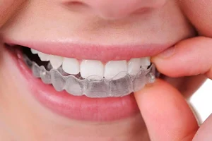 Smile World Orthodontic Centre - A Speciality Dental Clinic image