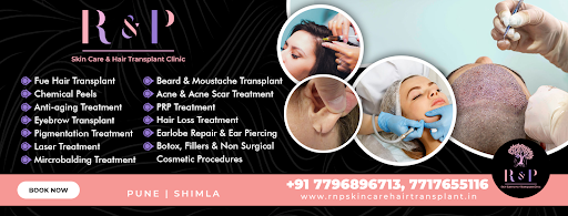 R & P Hair Transplant Clinic