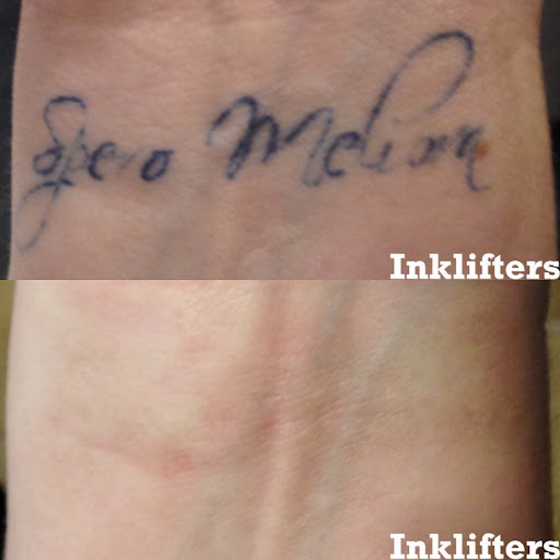 Find tattoo present ideas for your next unique tattoo in Pleasant Grove at Inklifters Tattoo Removal