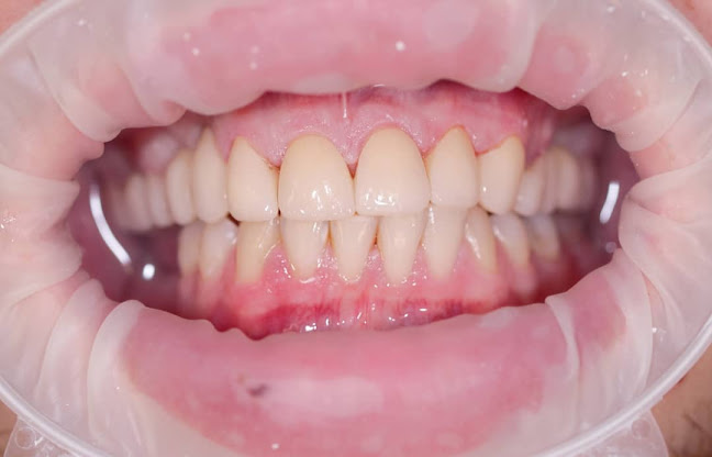 Art Dental Clinic | Zubná Ambulancia Prešov