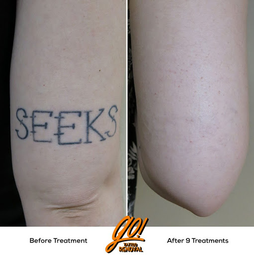 Explore letter g tattoo ideas, creative tattoo ideas in Allentown, available at Removery Tattoo Removal & Fading