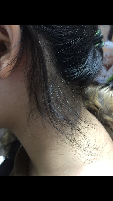 عيادة نمو الشعر بالليزر - The Laser Hair Growth Clinic