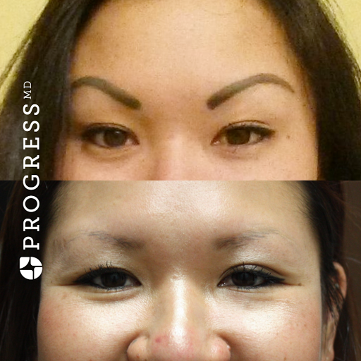 Explore one of one tattoo ideas, creative tattoo ideas in Amarillo, available at Progress MD Tattoo Removal