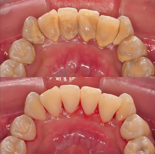 Opiniones de Glorydent Odontologia Integral en Cuenca - Dentista