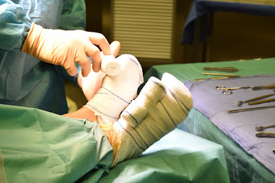 Docteur BECQUET Eddy | Chirurgie de la main et du pied à Nice