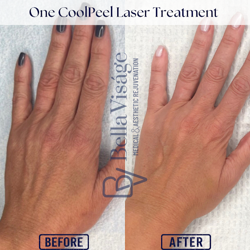 Explore self healing tattoo ideas, creative tattoo ideas in Lakeland, available at Bella Visge Medical & Aesthetic Rejuvenation