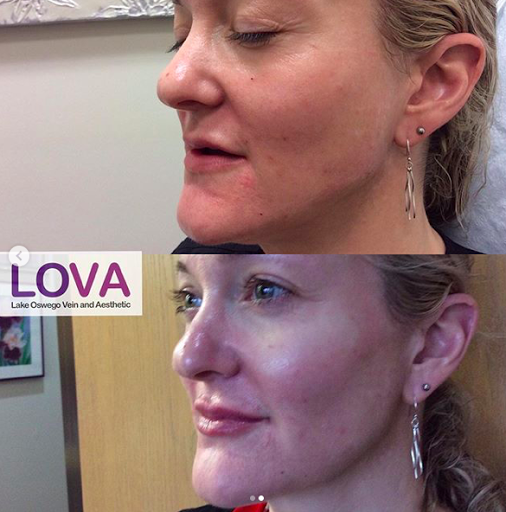 Explore angel and demon tattoo ideas, creative tattoo ideas in Lake Oswego, available at Lake Oswego Vein and Aesthetic LOVA