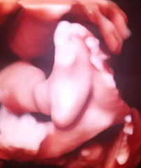 Baby Blessings Ultrasound Studio - Photo 4 - Car repair in Evansville, IN, Evansville