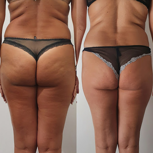 Avaliações doSkin and body perfect em Montijo - Salão de Beleza