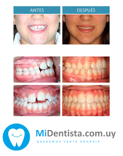 Comentarios y opiniones de Mi Dentista (Pando) Clínica Dental