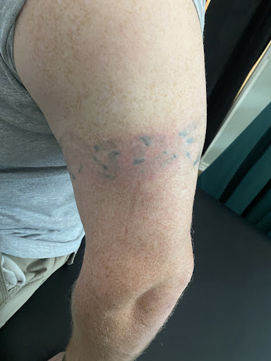 Explore sushi tattoo ideas, creative tattoo ideas in Lake Jackson, available at Second Chance Laser Tattoo Removal