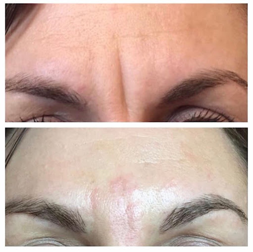 Indulgence Skin Laser and Beauty Clinic - Indulgence Skin Laser and Beauty Clinic