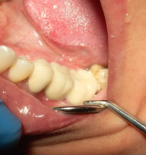 Dr. José Antonio Robledo Torres, Dentista – (Opañel)