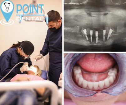 Point Dental - Point Dental