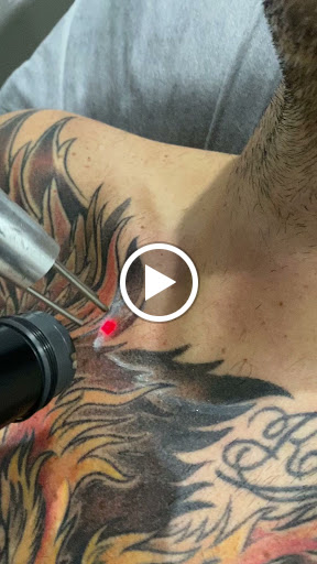 Explore december birth flower tattoo ideas, creative tattoo ideas in Naples, available at Laser Tattoo Removal Services