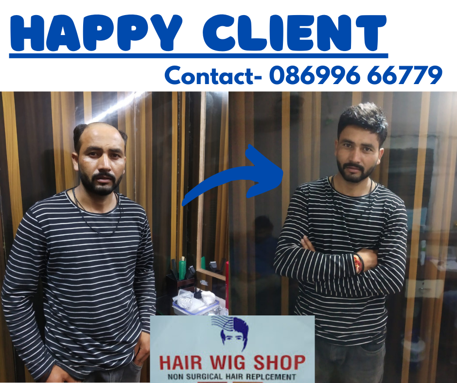 HAIR WIG SHOP - Best Wigs and Patches in Chandigarh