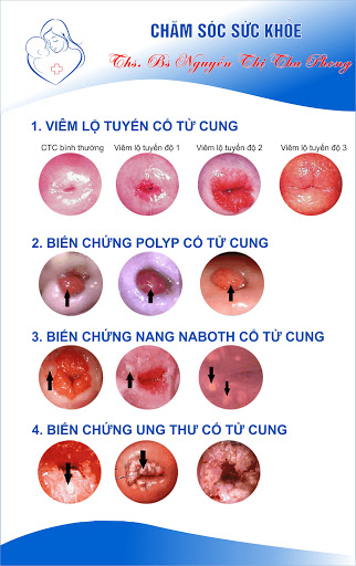 Af1qippdzf9hazll23eenqv Imcogufgjwbqfpqlgdmw