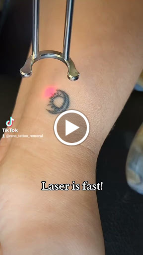 Explore arm and chest tattoo ideas, creative tattoo ideas in Reno, available at Reno Tattoo Removal