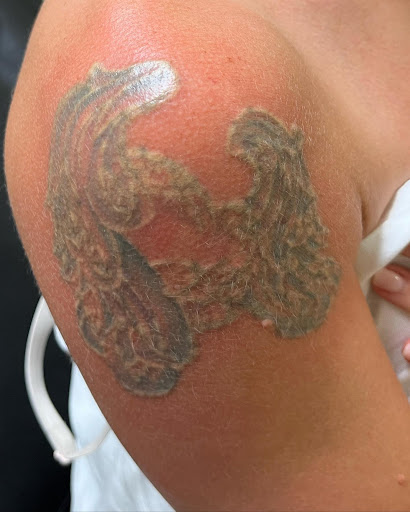 Find harley quinn tattoo ideas for your next unique tattoo in Orlando at Laser Procedure of Florida
