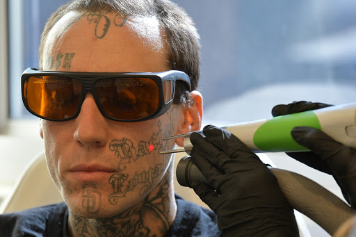 Explore moose tattoo ideas, creative tattoo ideas in San Diego, available at Evolve Tattoo Removal