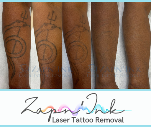 Explore firefighter tattoo sleeve ideas, creative tattoo ideas in Beaumont, available at ZapnInk Laser Tattoo Removal