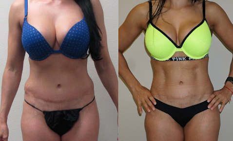 De La Cruz Plastic Surgery - Tomball - De La Cruz Plastic Surgery - Tomball