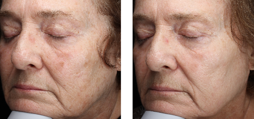 Medical Spa «Carillon Minneapolis Anti-Aging & Skin Clinic», reviews and photos, 755 Bielenberg Dr #104, Woodbury, MN 55125, USA