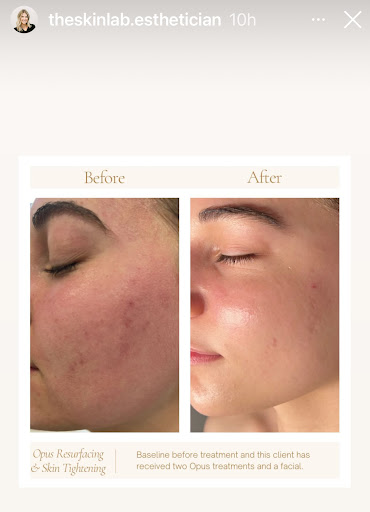 Explore custom tattoo ideas, creative tattoo ideas in Owensboro, available at The Skin Lab