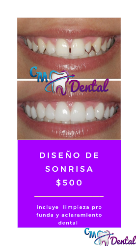 CM DENTAL Odontologia - Dentista