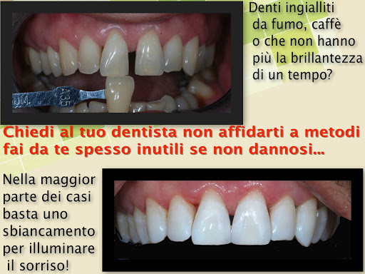 Studio di Odontoiatria Protesi Implantare ed Ortodonzia Dott.M.Sicilia