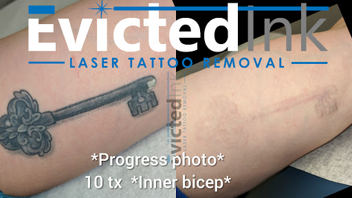 Explore marvel leg tattoo ideas, creative tattoo ideas in Wichita, available at Evicted Ink Laser Tattoo Removal