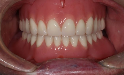 Boston Prosthodontics Dental Group