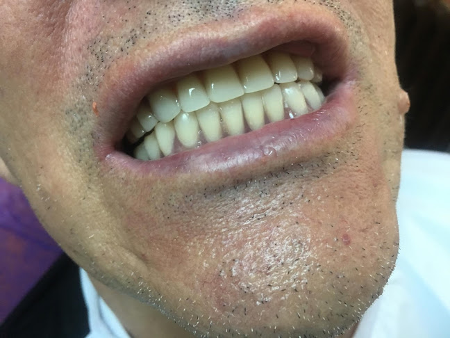 Dent Estetics - Clinica Stomatologica Trapezului, Ortodont Bun Bucuresti | Estetica Dentara Sector 3 - Dentist