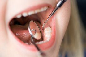 Dentalú, consulta dental Villarrica