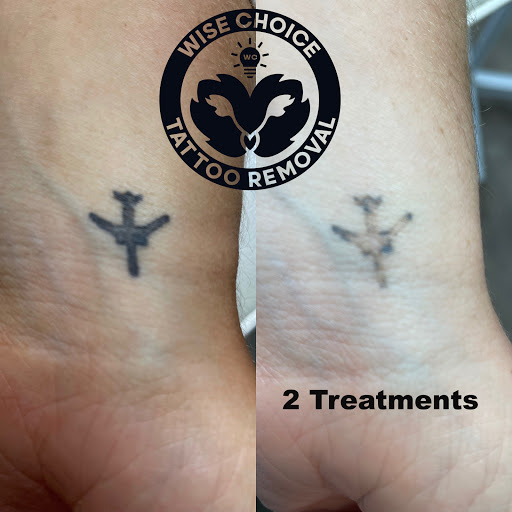 Explore lighthouse tattoo ideas, creative tattoo ideas in Denver, available at Wise Choice Tattoo Removal