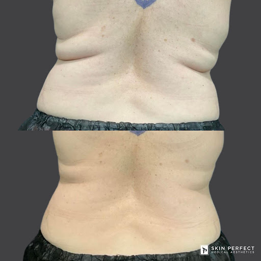 Explore one of one tattoo ideas, creative tattoo ideas in Whittier, available at Skin Perfect Medical Aesthetics