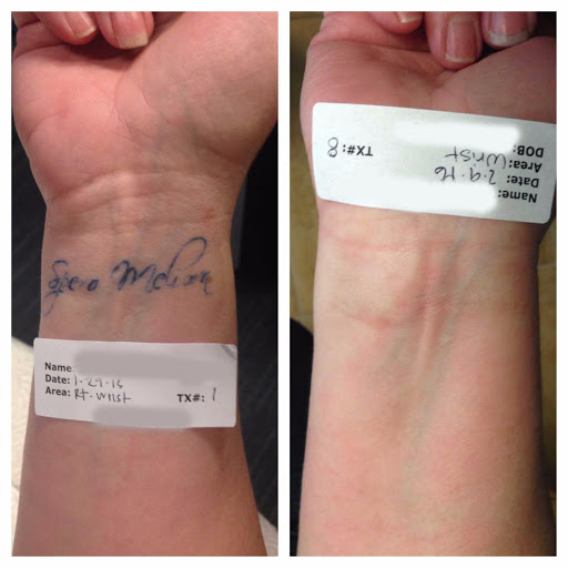 Explore ffx tattoo ideas, creative tattoo ideas in Pleasant Grove, available at Inklifters Tattoo Removal