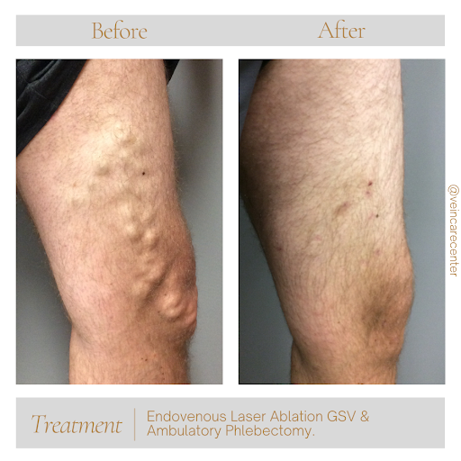 Explore god is greater than the highs and lows tattoo ideas, creative tattoo ideas in Lima, available at Vein Care Center Laser Specialists