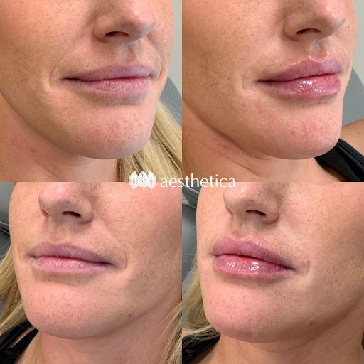 Explore ear tattoo ideas for women, creative tattoo ideas in Pleasant Grove, available at Aesthetica