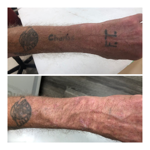 Explore heart tattoo ideas with names, creative tattoo ideas in Tyler, available at Vanish Laser Aesthetics