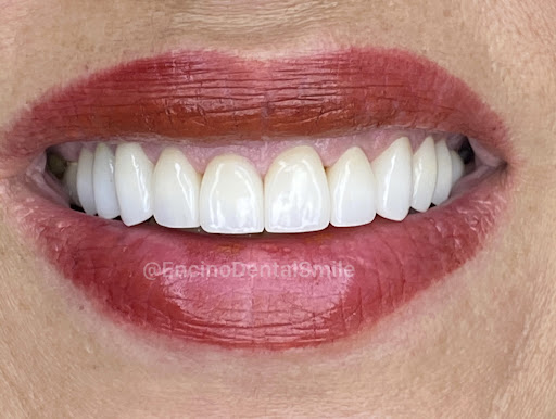 Encino Dental Smile image