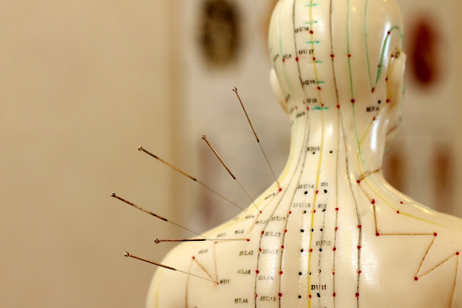 TCM Praxis GAOU Romanshorn & Amriswil für Akupunktur und Chinesische Medizin