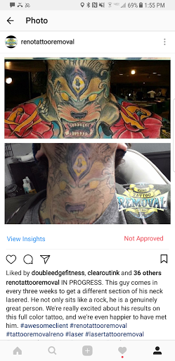 Explore mid arm tattoo ideas, creative tattoo ideas in Reno, available at Reno Tattoo Removal